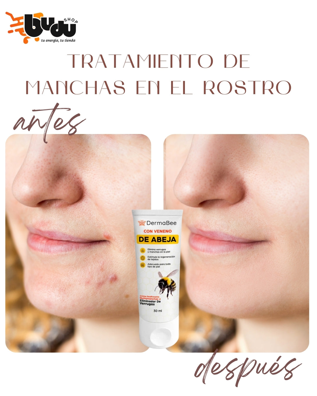 DERMABEE® – Crema tópica a base de veneno de abeja, hecho con ingredientes 100% naturales.